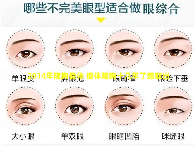2014年隆胸假体 假体隆胸十几年了想取出